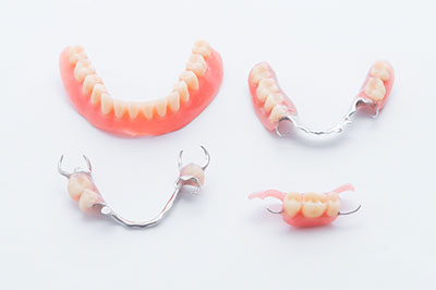 A collection of dental braces displayed on a white background, showcasing various designs and styles.