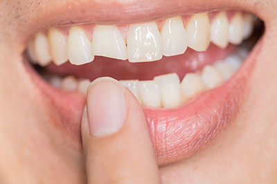 An individual with a toothpick in their mouth, smiling at the camera.