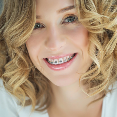 A woman with a radiant smile, wearing braces, poses for the camera.