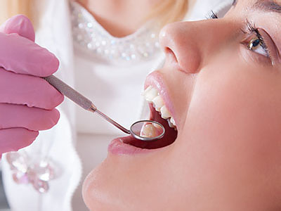 An image featuring a dental professional performing oral care on a patient, with the patient s mouth open and the dentist using a drill.